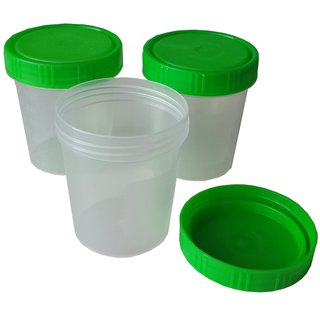 Urinbecher mit Schraubdeckel