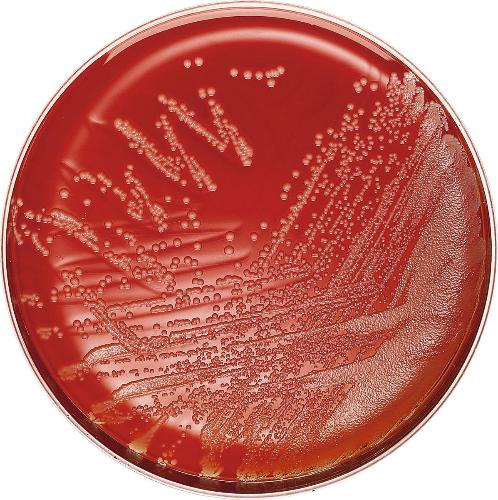 MacConkey/Columbia-CNA Agar mit Schafblut BD